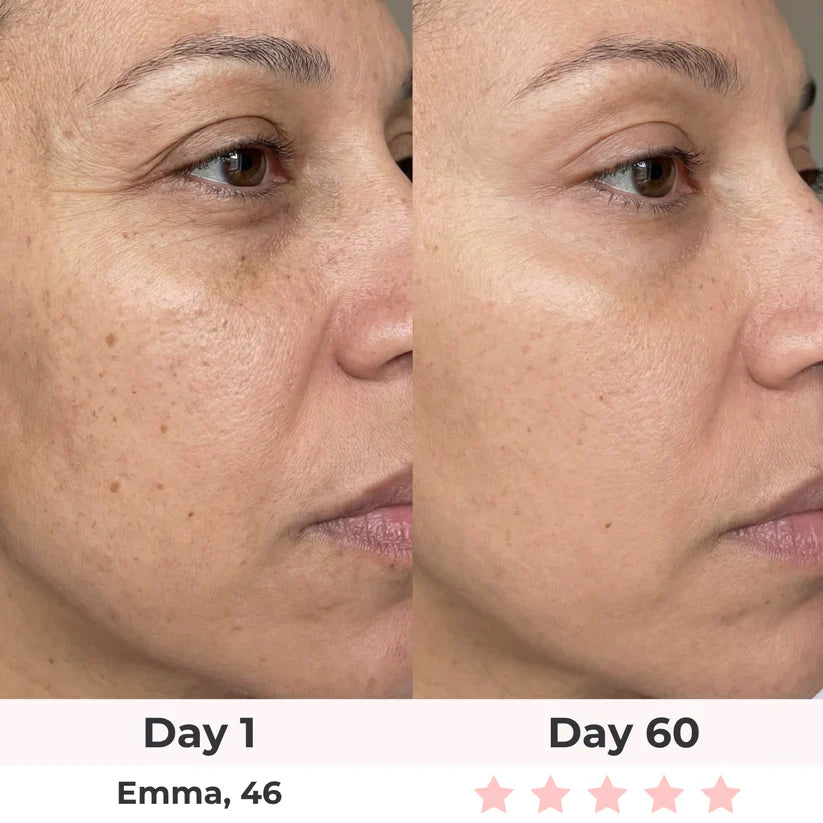 Before and after results - Emma, 46 - Day 60