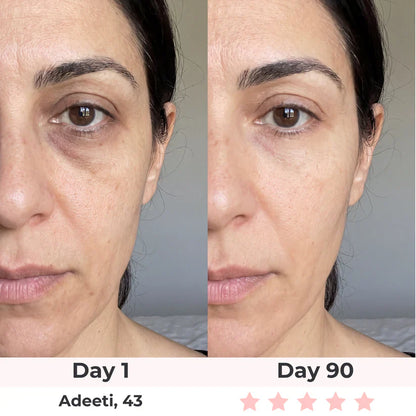 Before and after results - Adeeti, 43 - Day 90