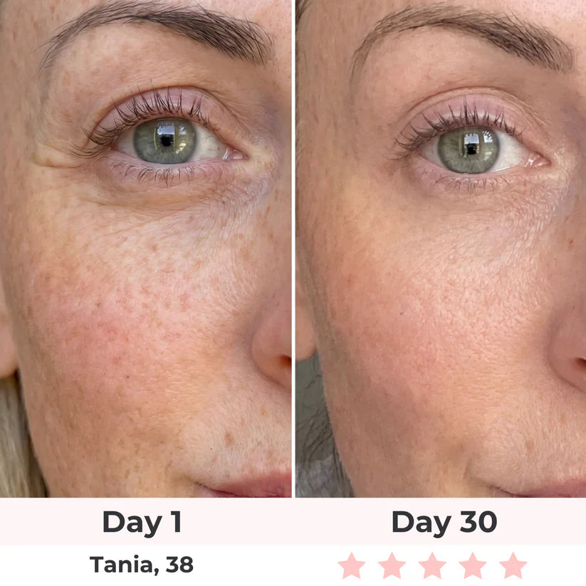 Before and after results - Tania, 38 - Day 30