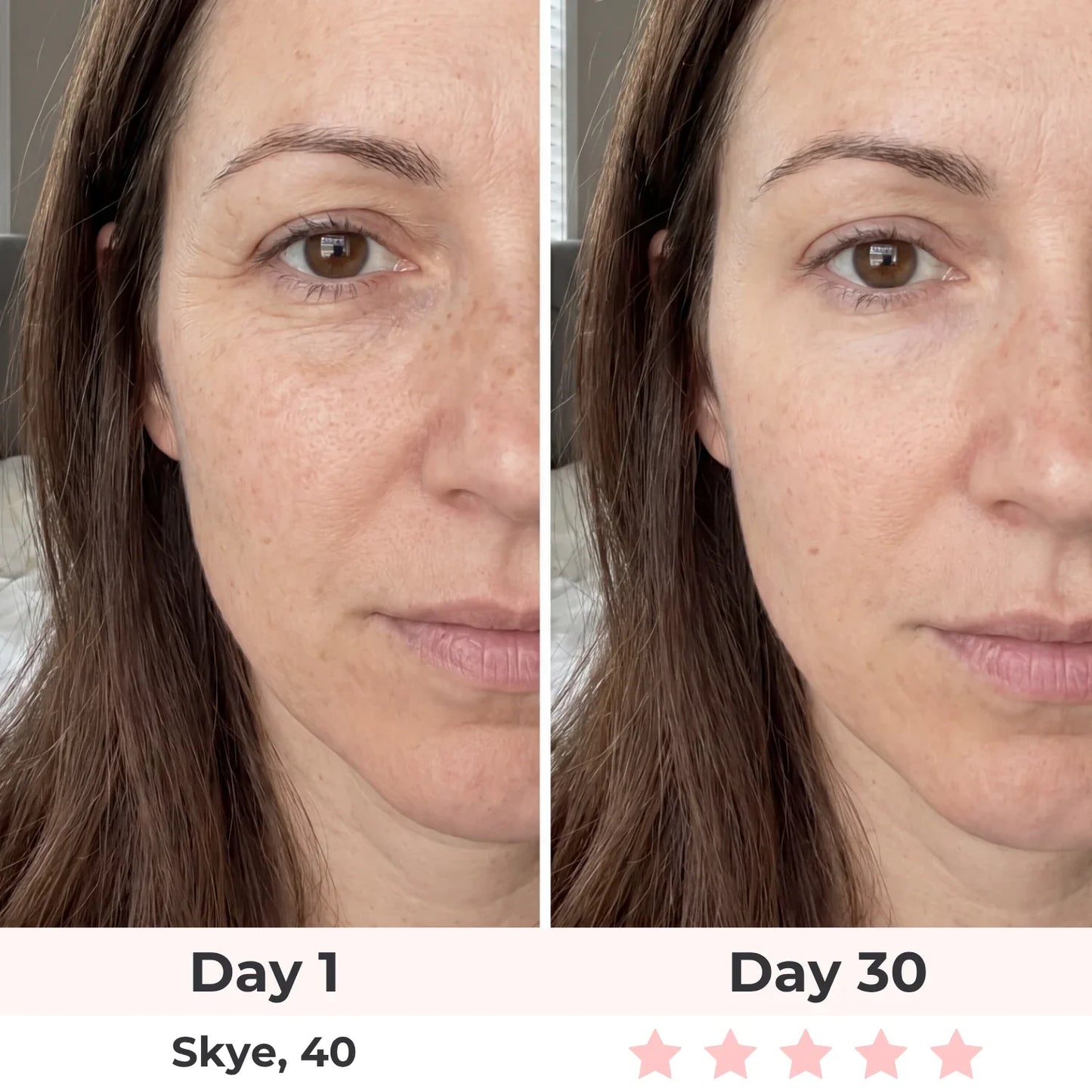 Before and after results - Skye, 40 - Day 30