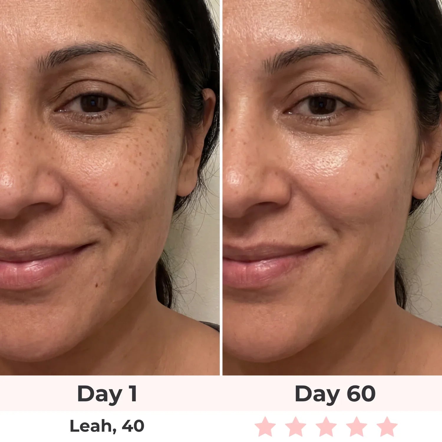 Before and after results - Larissa, 44 - Day 90