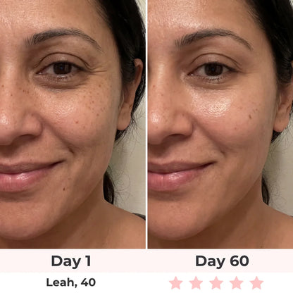 Before and after results - Larissa, 44 - Day 90