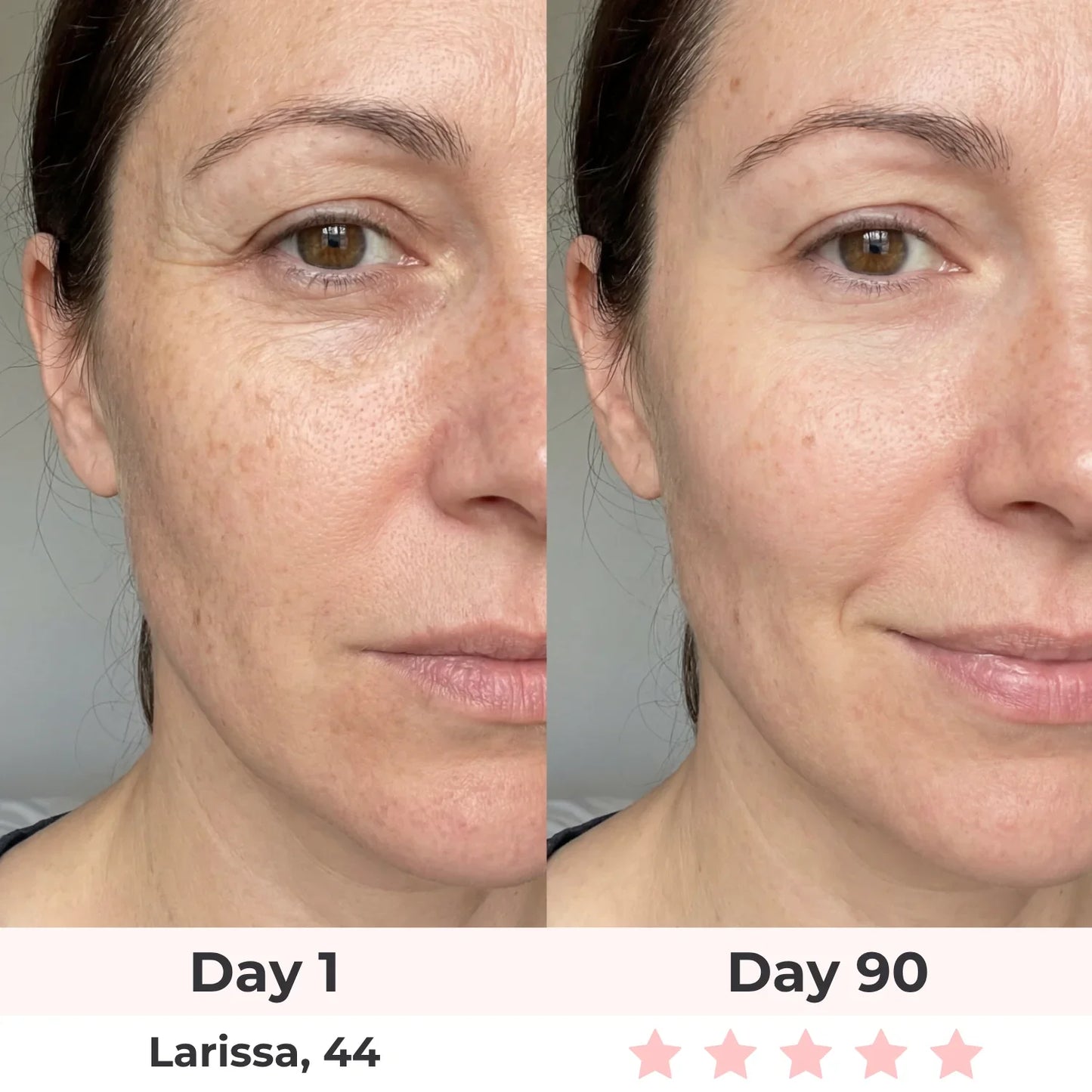 Before and after results - Leah, 40 - Day 60