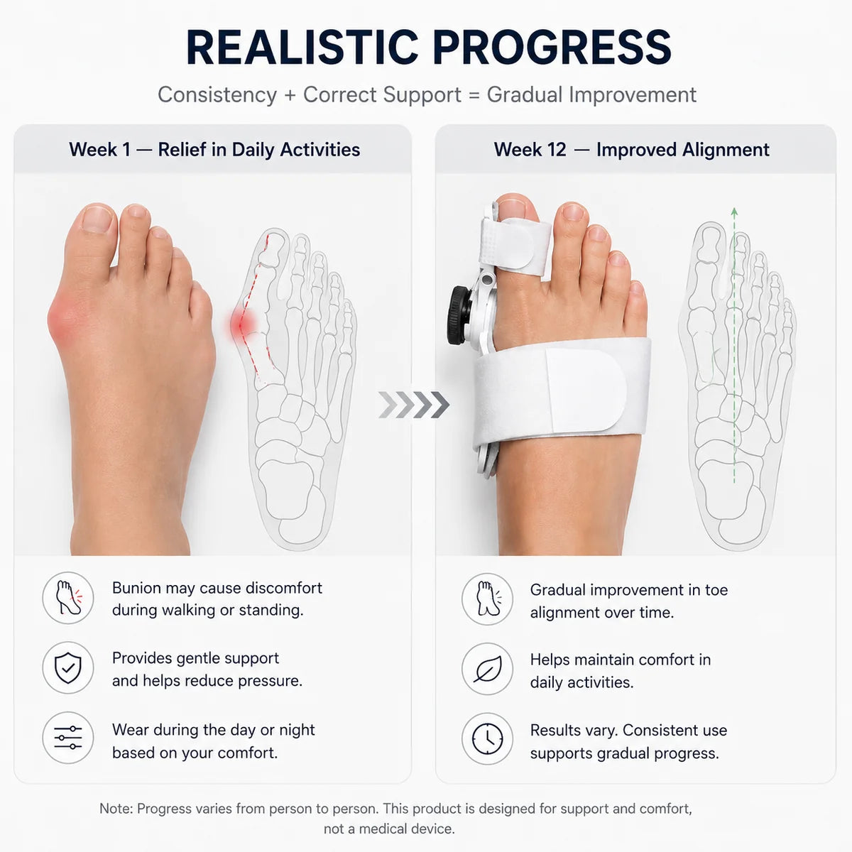 LumiVera™ ToeFix Bunion Corrector