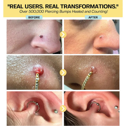 LumiVera Base Keloid Scar Repair Duo