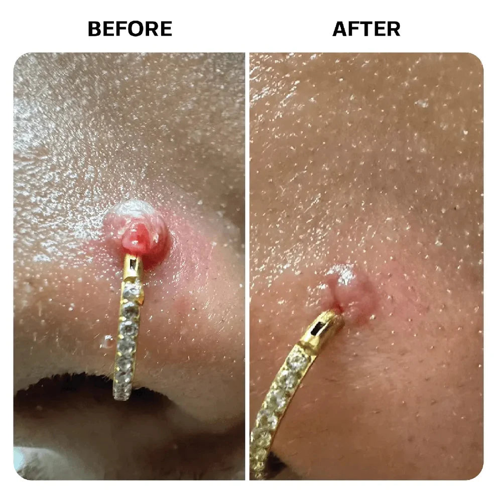 LumiVera Base Keloid Scar Repair Duo