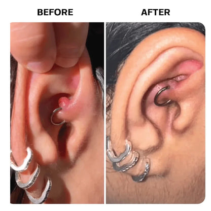 LumiVera Base Keloid Scar Repair Duo